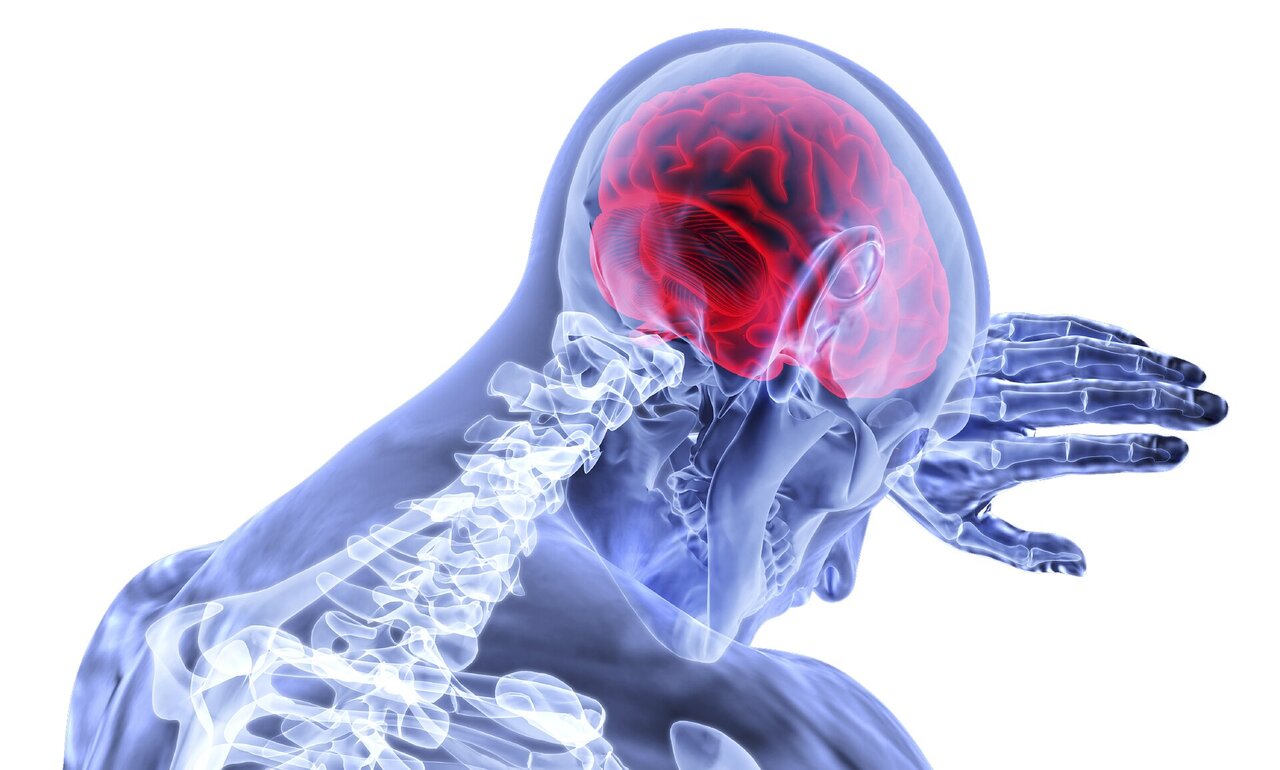 multiple sclerosis adalah penyakit