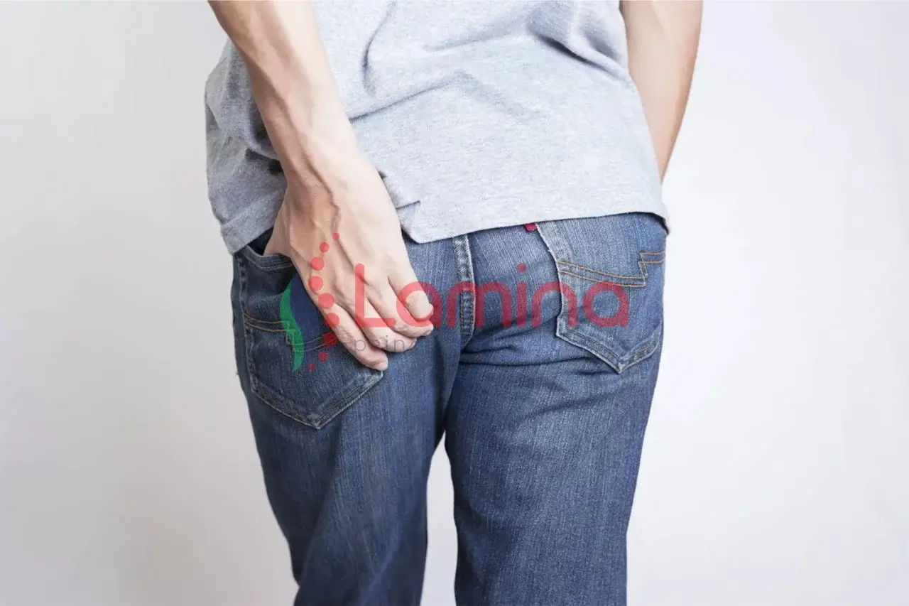 pengobatan sindrom piriformis