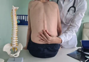 kifosis kelainan tulang belakang - Lamina Pain and Spine Center