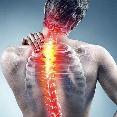 Ilustrasi tulang belakang manusia dengan area merah menunjukkan saraf kejepit
